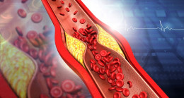 Araştırma: Yüksek seviyede kolesterol demansa yol açabiliyor