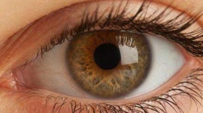 Katarakt cerrahisinde bu yöntem ömür boyu gözlükten kurtarıyor