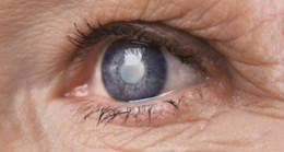 Katarakt ameliyatı olanların beyni daha genç kalıyor!