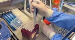 Moleküler testlerle salgın hastalık olup olmadığı takip ediliyor