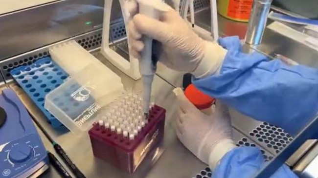 Moleküler testlerle salgın hastalık olup olmadığı takip ediliyor