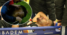 Kayserispor-Fenerbahçe maçında talihsiz sakatlık! Carole baygınlık geçirdi, hastaneye kaldırıldı