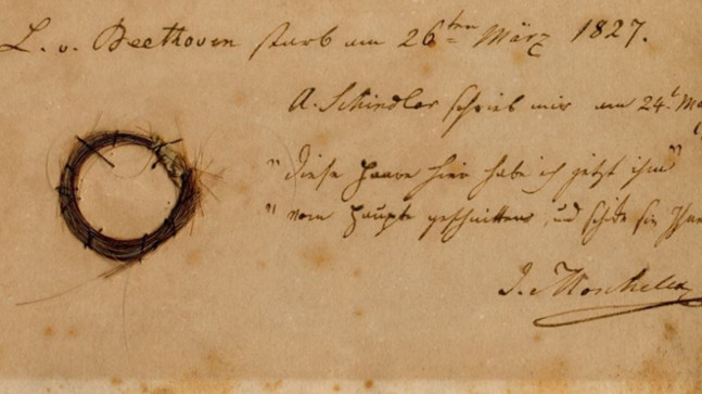 Karaciğer hastalığı, hepatit B, siroz; bilim insanları Beethoven’ın saç tellerini inceleyerek sağlık durumunu ortaya çıkardı